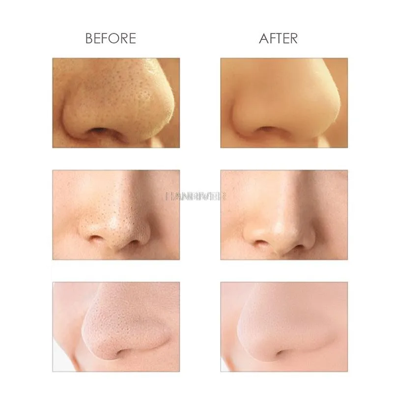 마사지 진동 미용 눈가 기기로 얼굴 피부를 리프팅하고 탄력 있게 가꾸어주는 미용 기기