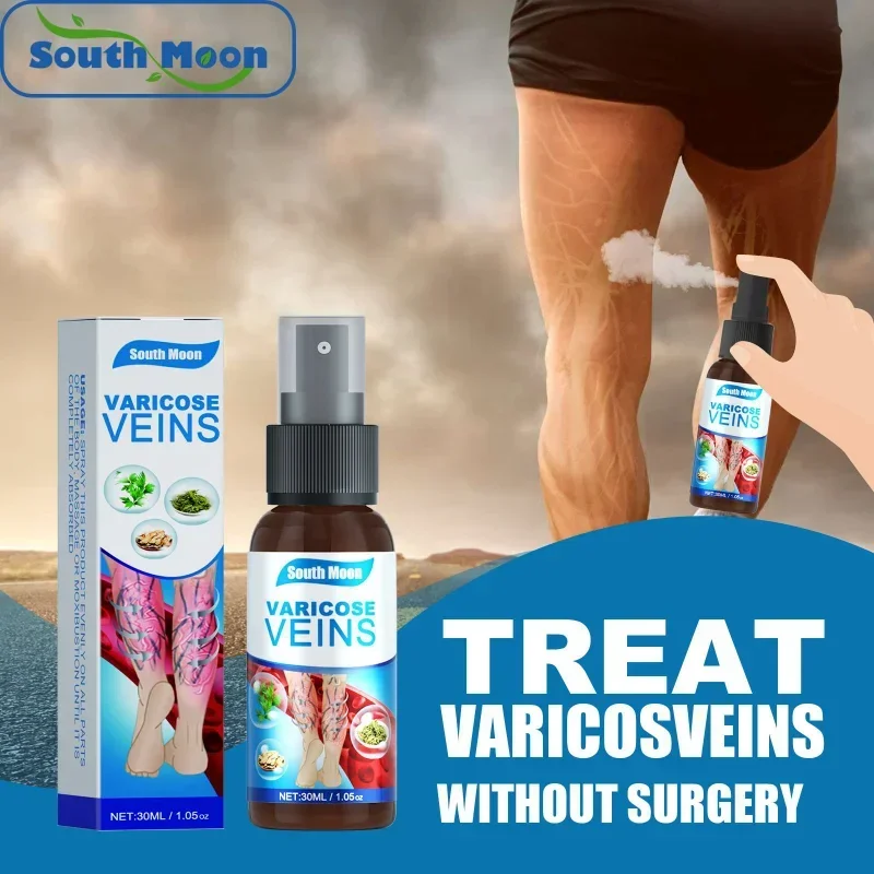 Spray for varicose veins Effective varicose vein relief cream to relieve Leg vasculitis phlebitis spider pain swelling treatment