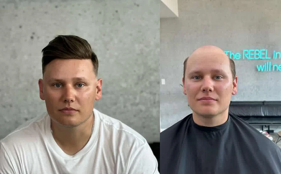 Men's Capillary Prosthesis Skin With Knot Toupee Invisible Wig Man Human Hair Prosthesis Man Natural Hair Replacement System