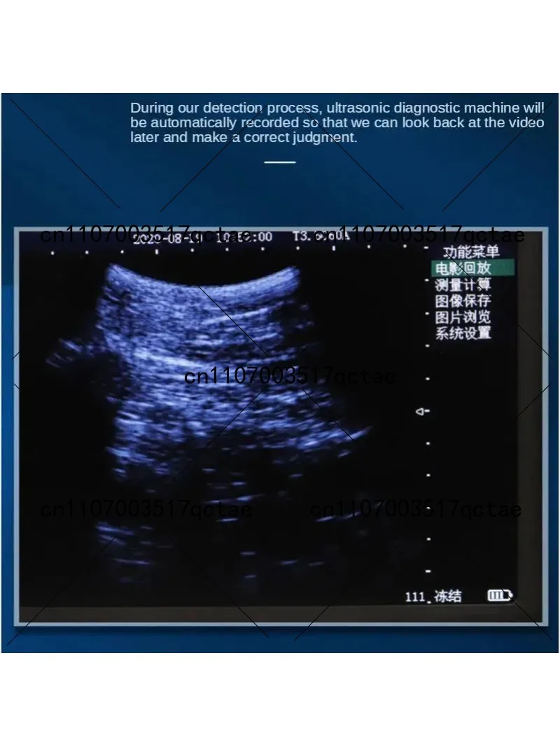 5.6 Inch LCD Screen Portable Veterinary Ultrasound Scanner For Cattle Cow Pig Horse Ultrasound pregnancy testing Machine Color