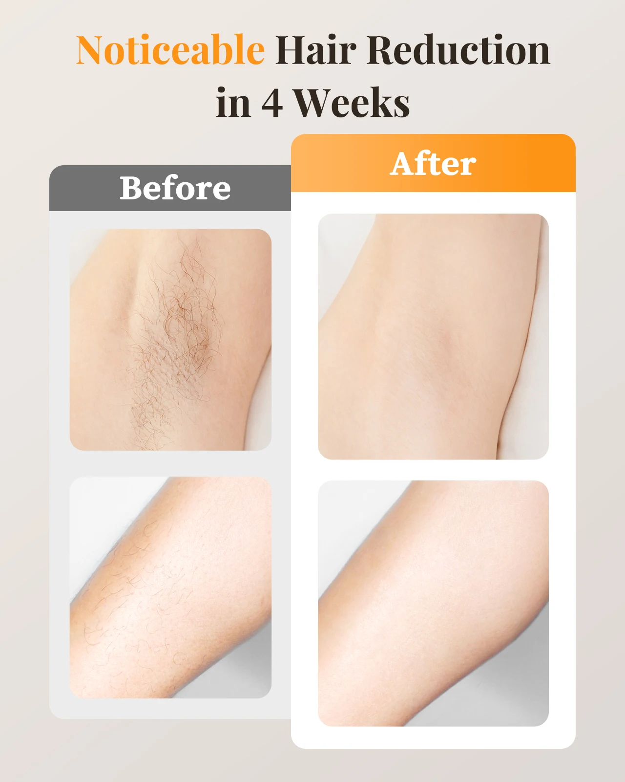 Laser Hair Removal Unlimited Flash Ice-cooling IPL Device 18.6J Painless & Long-Lasting Results Full Body Treament for Women Men image 4