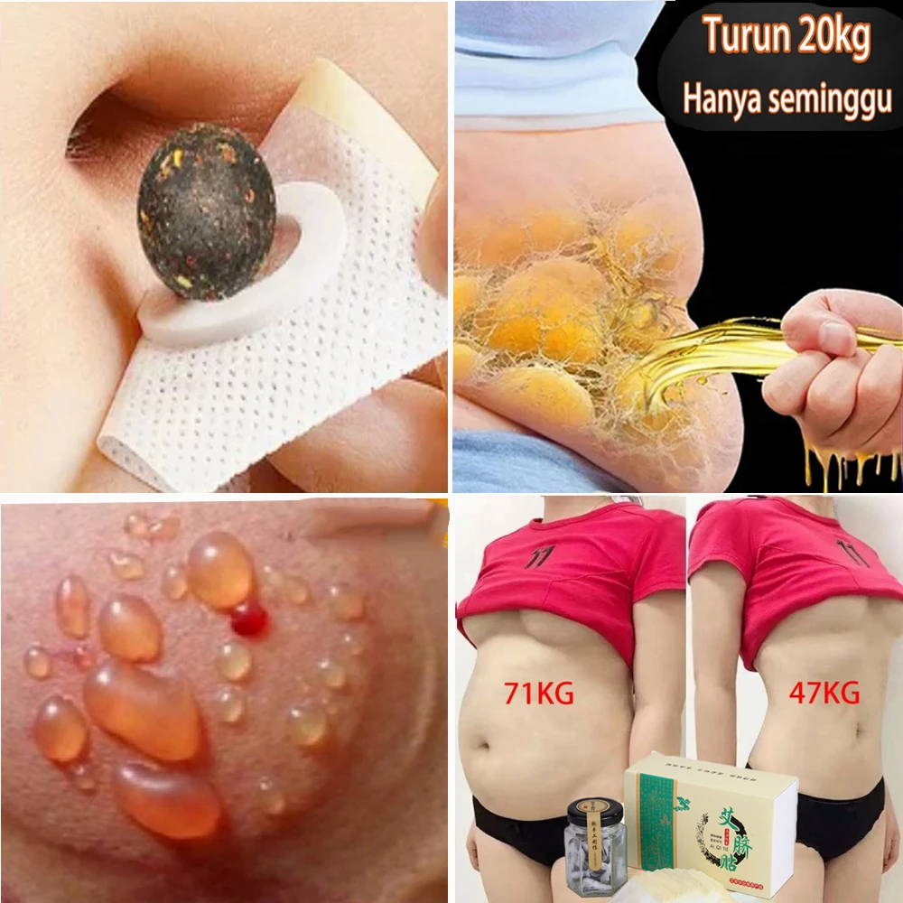 Slim Patch Burn Fat Cells & Lose Weight Moxibustion Fat Burning Arm Slimming / Pelekat Kurus