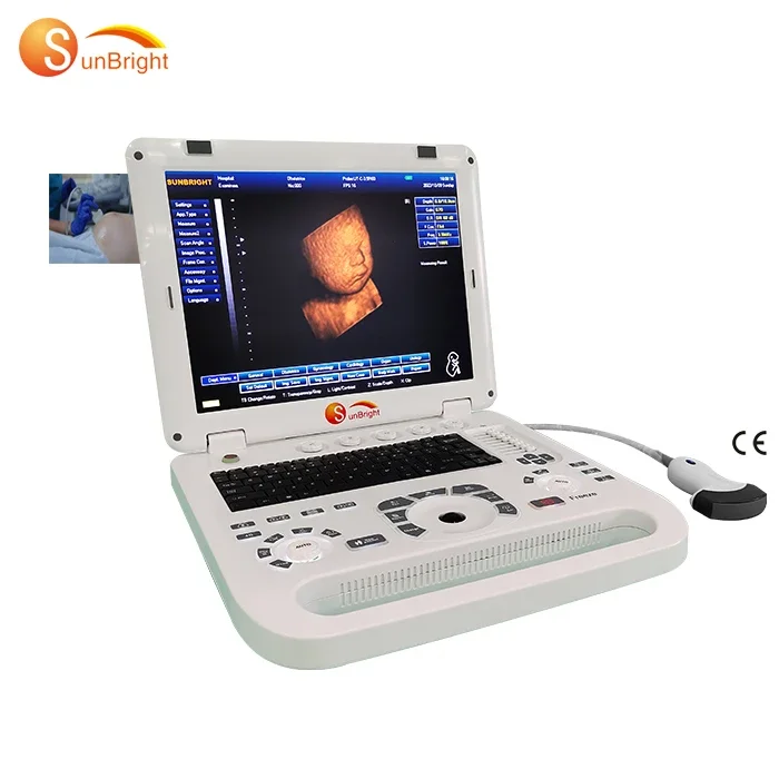 

Sunbright Portable Veterinary Ultrasound Clinic Handheld Ultrasound Machine Pet Ultrasound Machine For Animal