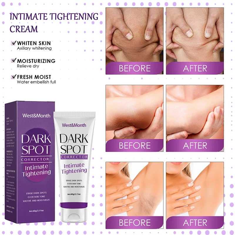 Quickly Whitening Cream Remove Melanin Dark Skin Brightening Cream Underarm  Inner Thighs Elbows Bleach Joint Whitening Cream