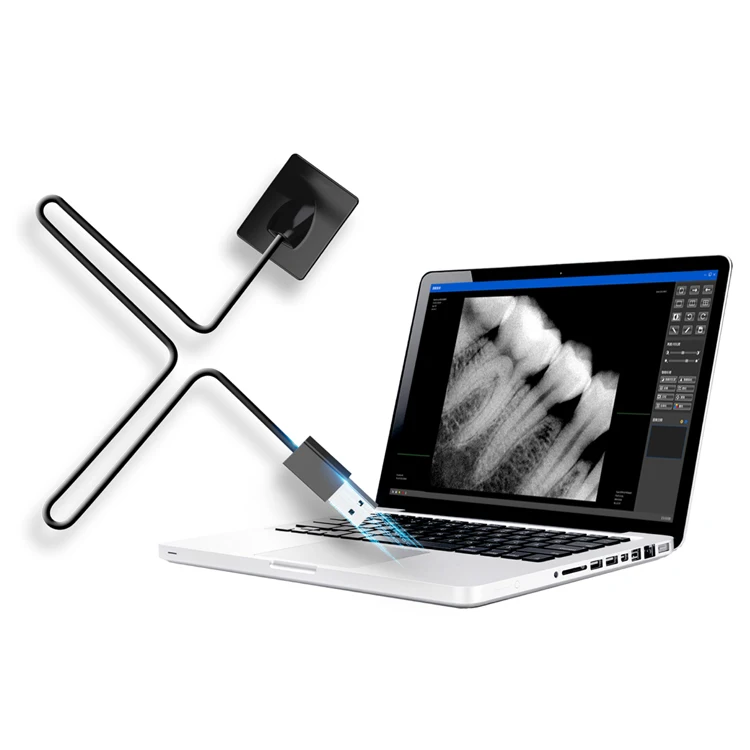 Manufacturer Price Cheap Clear Intraoral Imaging Portable Tooth Radiography Sensor For Dentist Clinic