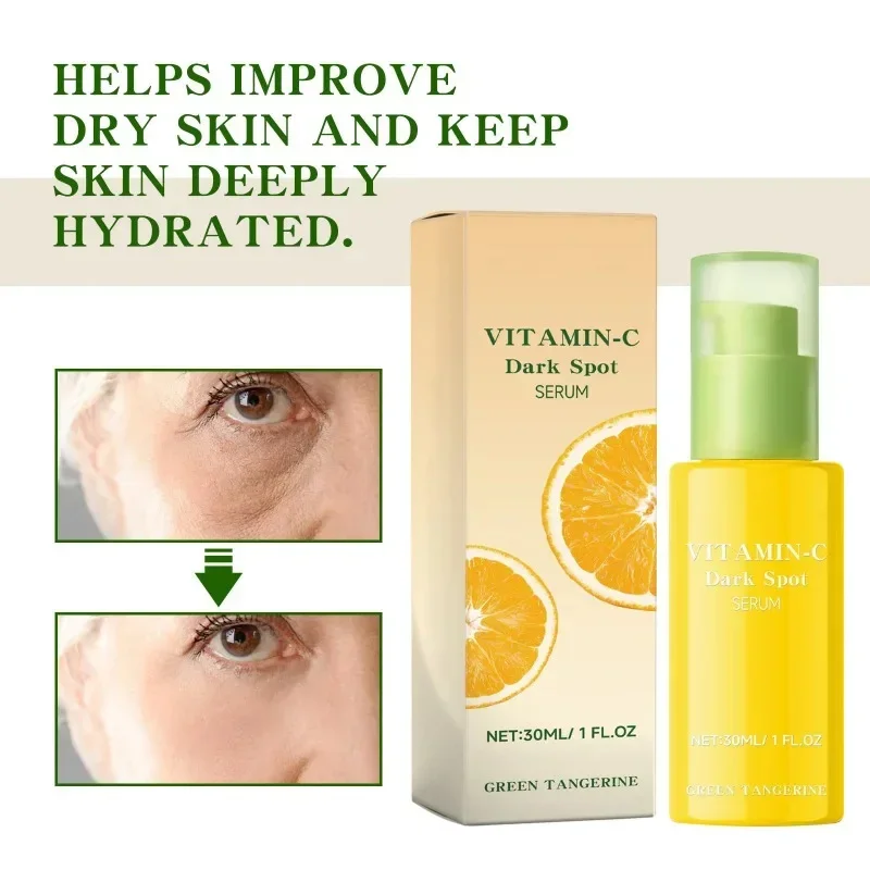 Effective Remove Melasma Serum Vitamin C Brightening Face Serum Korean Lighten Dull Skin Essence Women Fade Chloasma Care