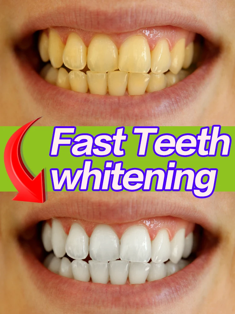 Removal Plaque Stain Teeth Whitening