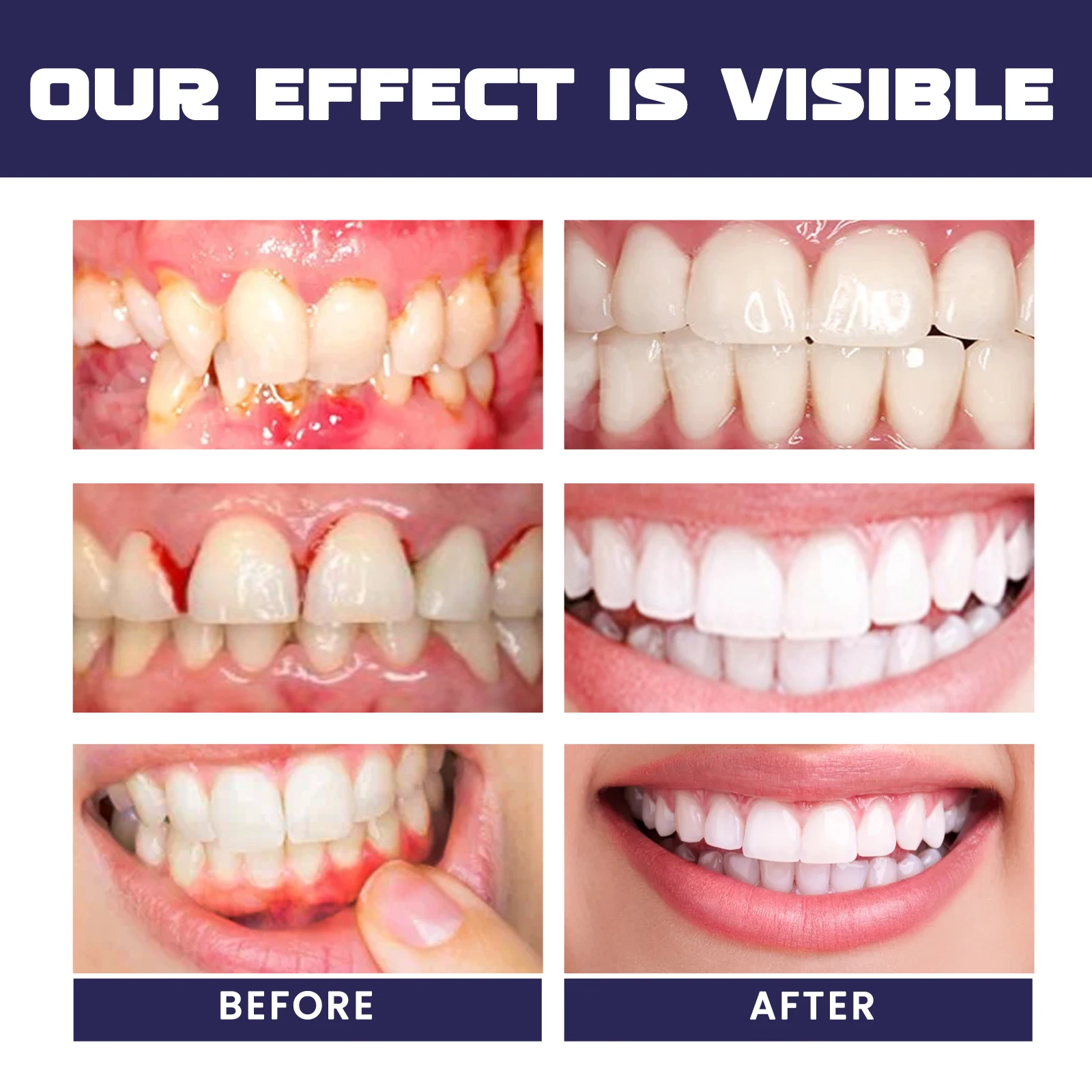 Riparazione rapida Gengive dan - Teeth Whitening Serum recensione e prezzo
