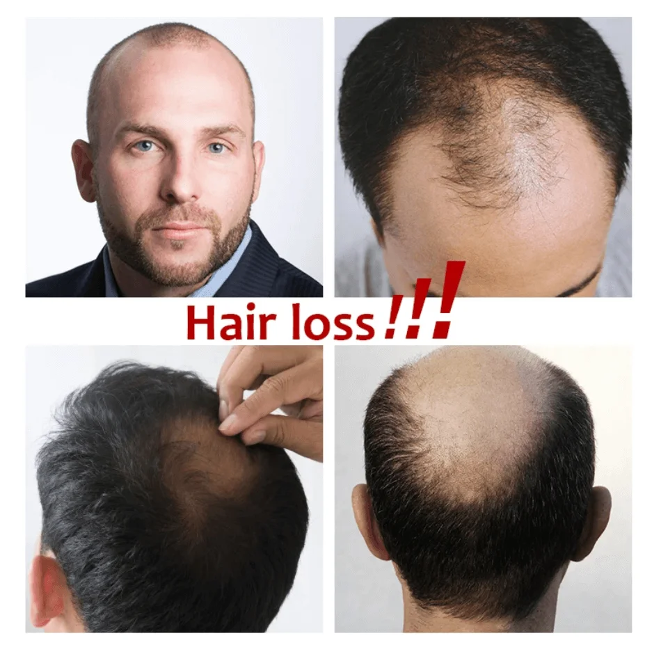 Full Swiss Lace Toupee Men Breathable Capillary Prothesis Invisible Bleach Hairline 100% Human Hair Replacement System Male Wig