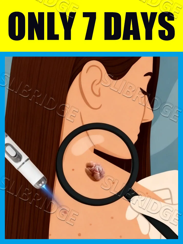 2025 Pelle liscia: acquista una penna laser per la rimozione delle verruche dalla luce blu ora per godersi