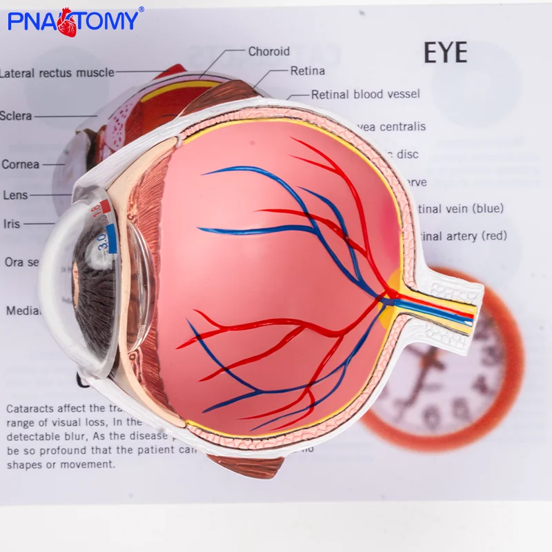 

Pathological Eye Model Eye Model Corneal Disease Eye Model