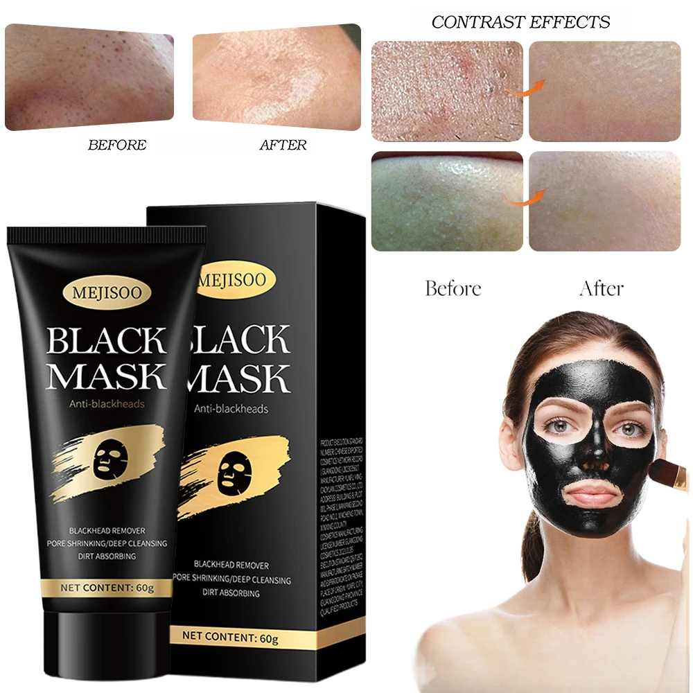 

Remove Blackheads Absorb Acne Black Facial Mask Clean Acne Moisturize Men And Women Apply Facial Mask Korean Face Care Products