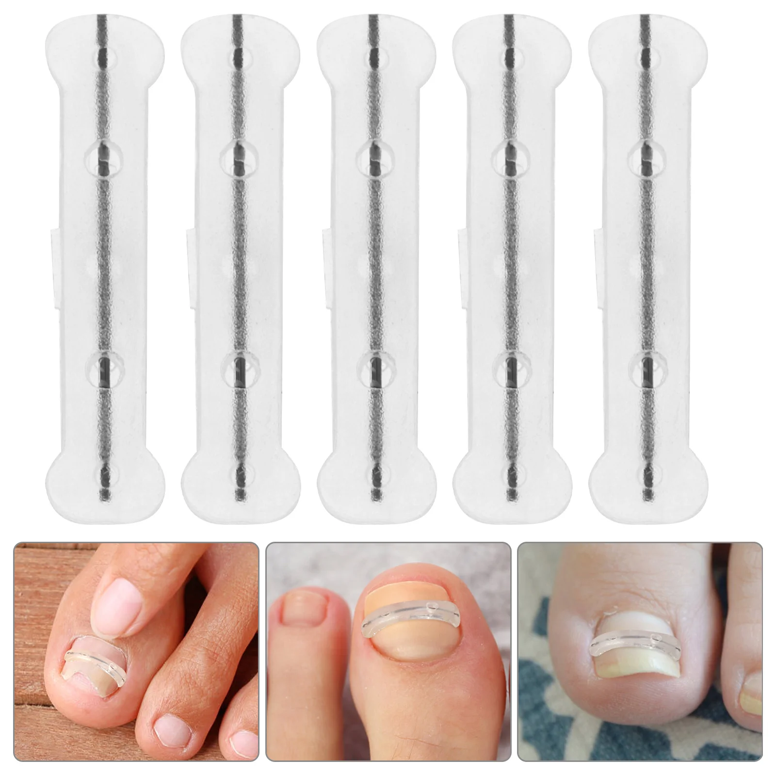 

Titanium Alloy Nail Corrector for Ingrown Toenail Treatment Professional Reusable Compact Toenail Care Use Silicone