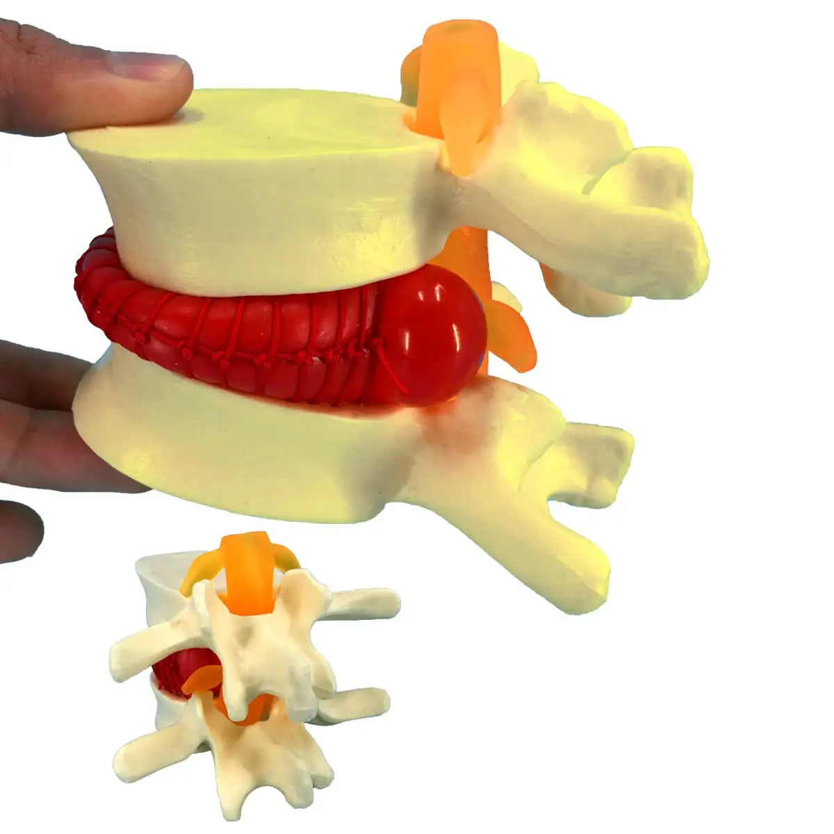 

Life Size Human Lumbar Disc Herniation Demonstration Model Spine Biology Medical Skeleton Toy