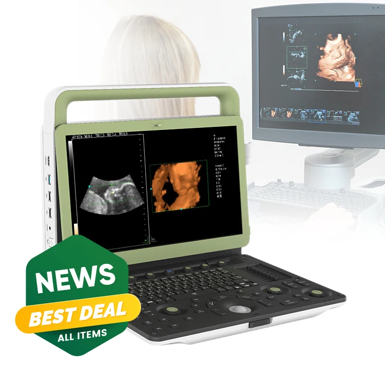 2023 New arrival custom medical ultrasonography 3d 4d ecocardiografo portatil ultrasound therapy machine physiotherapy