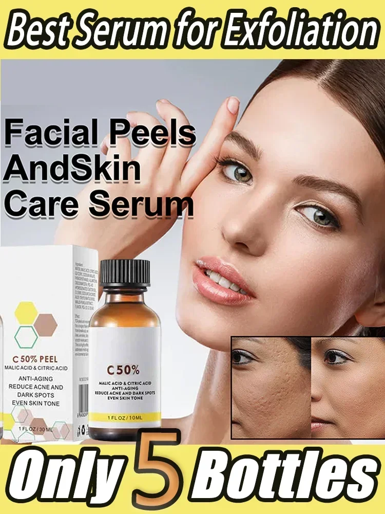 [Especial] aceite exfoliante exfoliante exfoliante Facial blanqueamiento hidratante reparación nutritiva exfoliantes crema Facial belleza cuidado de la piel Peeli