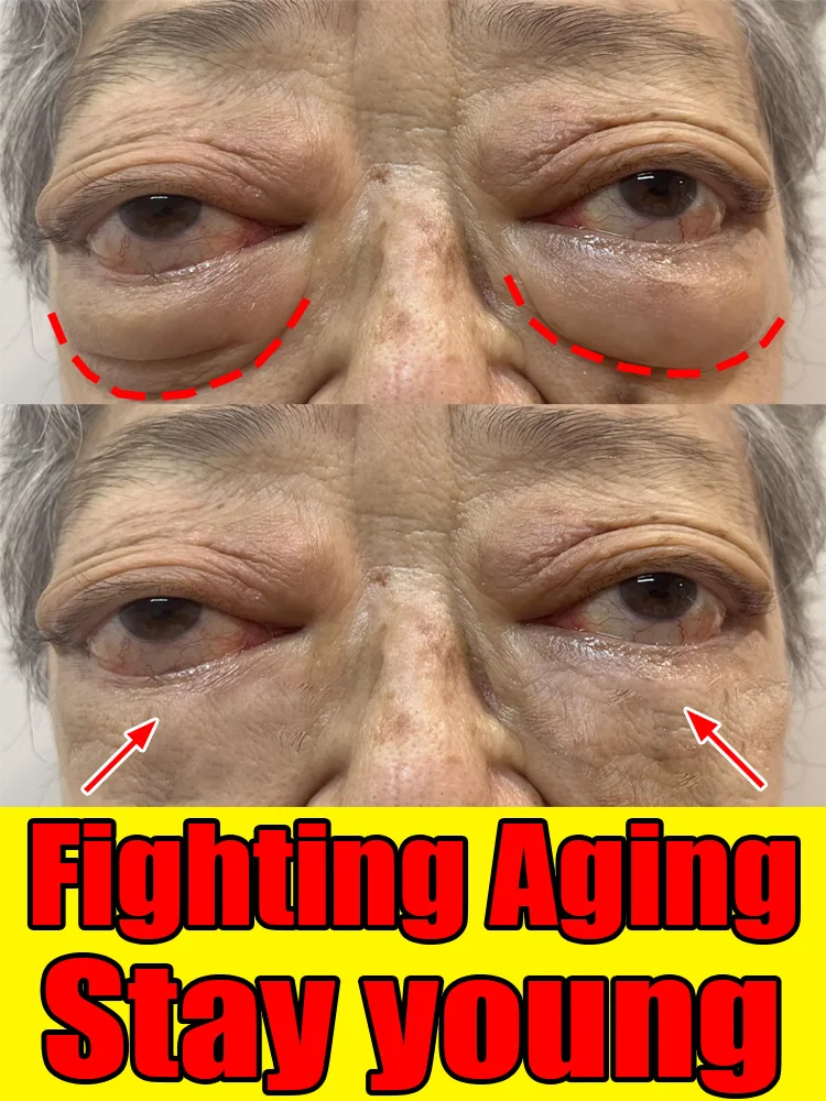 Firming Anti-Wrinkle Eye Cream: Reduces dark circles, improves eye bags and puffiness, provides hydration and anti-aging benefits; eye area skincare.