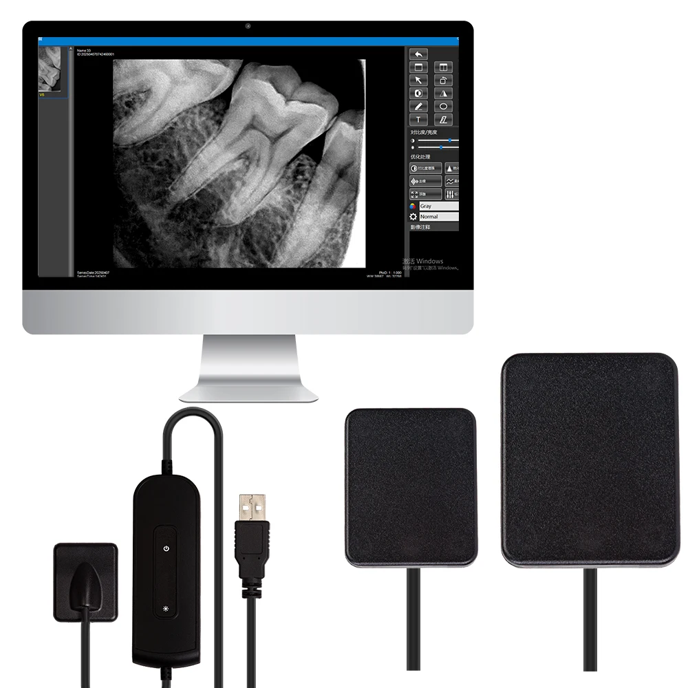 Portable Rayos X Digital RVG Intraoral Sensor Radiovisografo HD Image  Sensor For Clinic