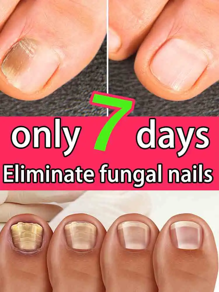 

Handle all the nail trouble