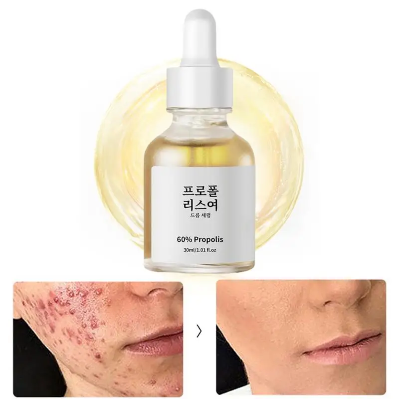 60ml Propolis essence Nourishing Honey Toner Propolis Energy Boosting Cream Oil control, acne removal Pore shrinking essence