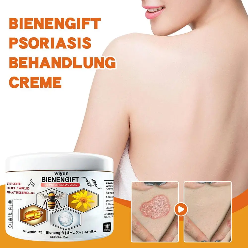 30g Bee Venoms Joint Care Cream Relieve Cervical Joint Soreness Massage Treatments Cream Bone Health Body Care Tools