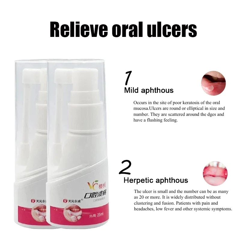 VC Cherry Breath Freshener 25ml Oral Spray Portable Mouth Spray Halitosis Ulcer Treatment Spray Protect Teeth Clean Health Care