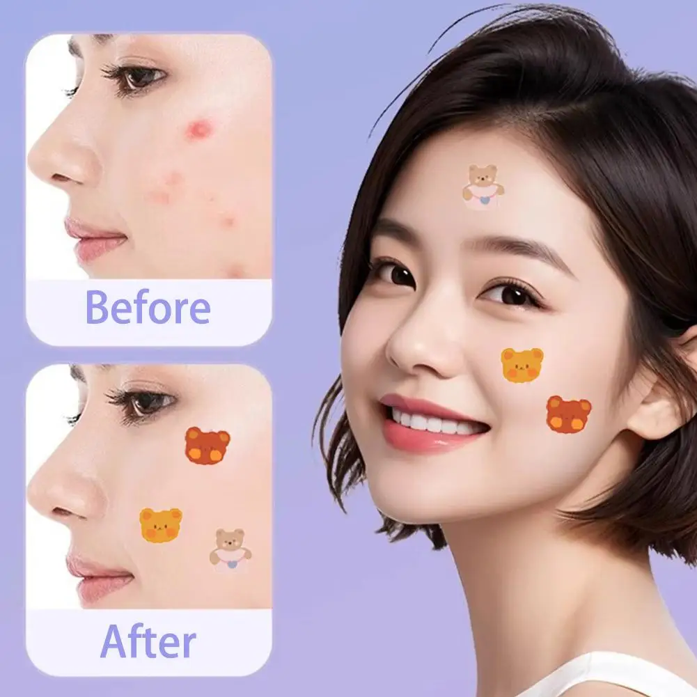 100 قطعة من ملصقات البثور الكرتونية على شكل الدب لإزالة حب الشباب من البولي إيثيلين خفيفة الوزن ومريحة للتنفس أداة العناية ببشرة الوجه