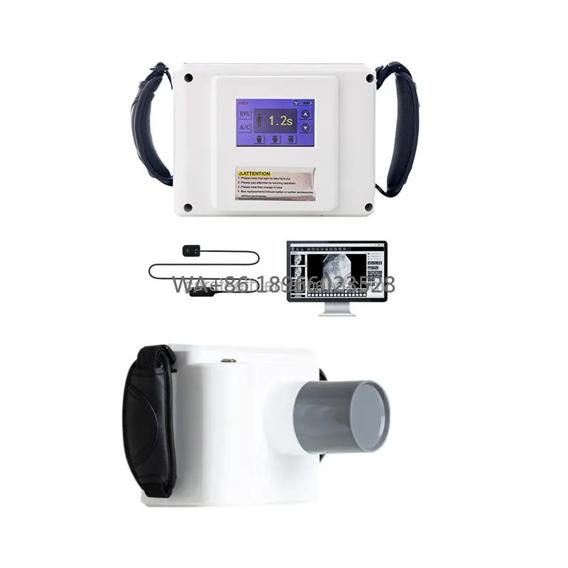 Dental Blue High-Precision Imaging Dental Imaging Wide Applicability Dental Examination Products Portable X Ray