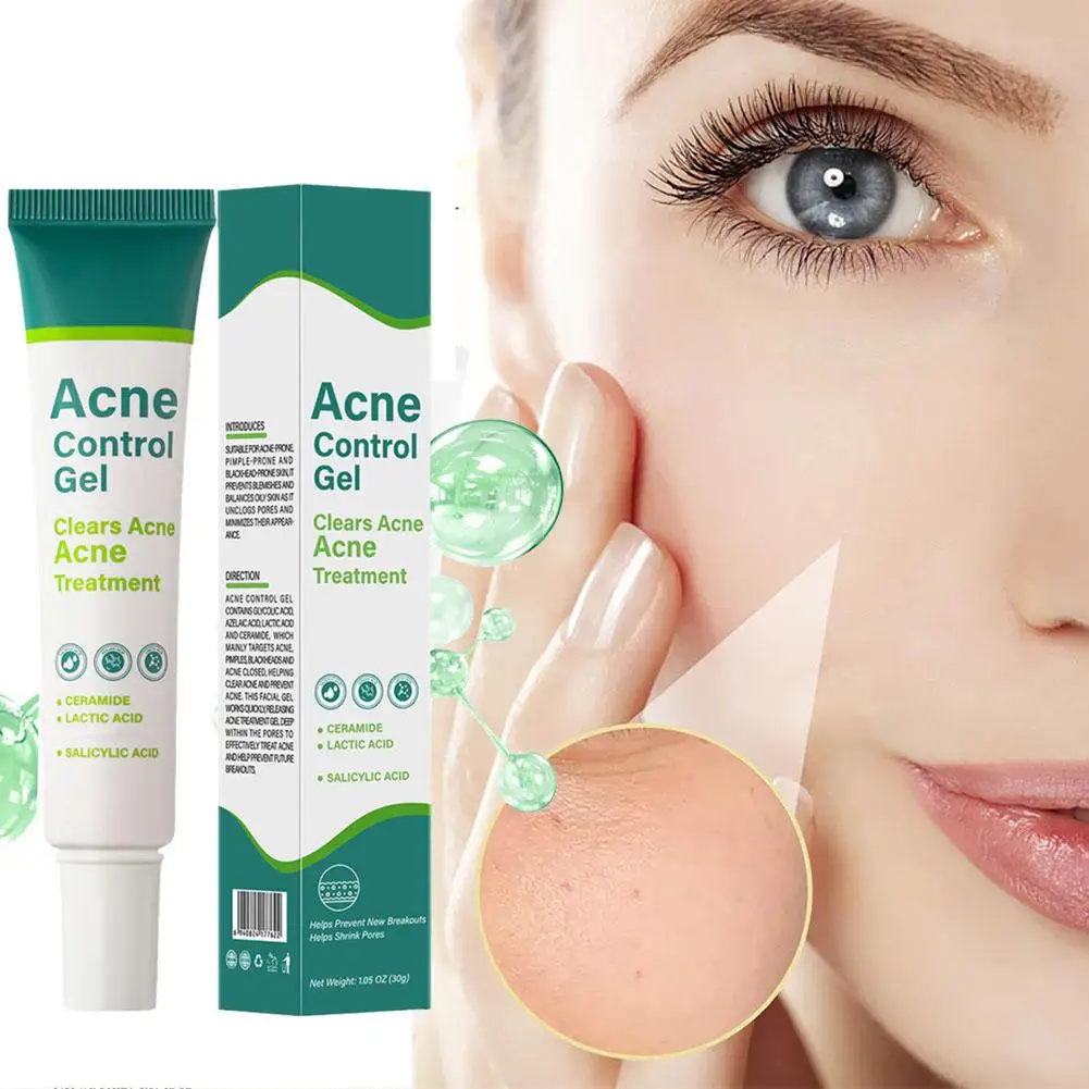 Salicylic Acid Gel Reduces Acne Marks, Shrinks Pores, Closes Ceramide Acne, Removes Acid Lactic Cream Acne Mouth, T1j4