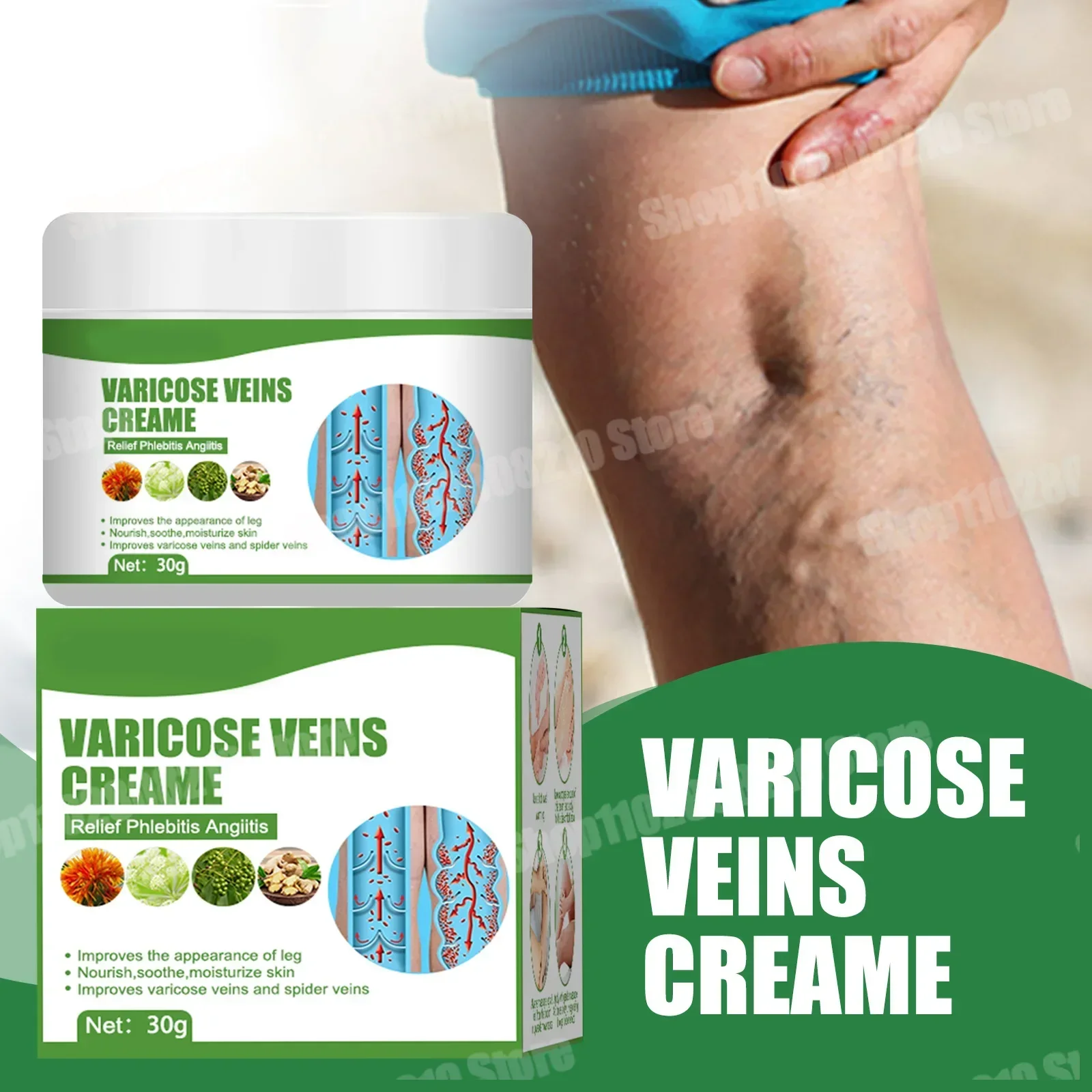 Creme de tratamento de veias varicosas, remove estrias vermelhas no sangue, varicocélula, vasculite, flebite, fortalece a saúde capilar