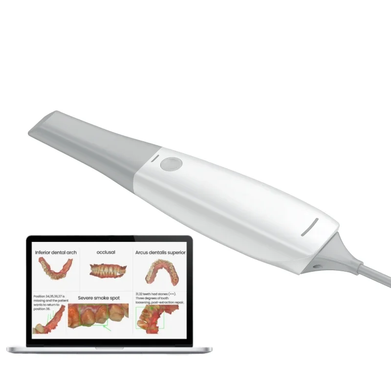 2 Year Warranty Portable Fussen Digital Intraoral Scanner System S6500 3D Real Colour Scan for Implant Orthodontics Restoration