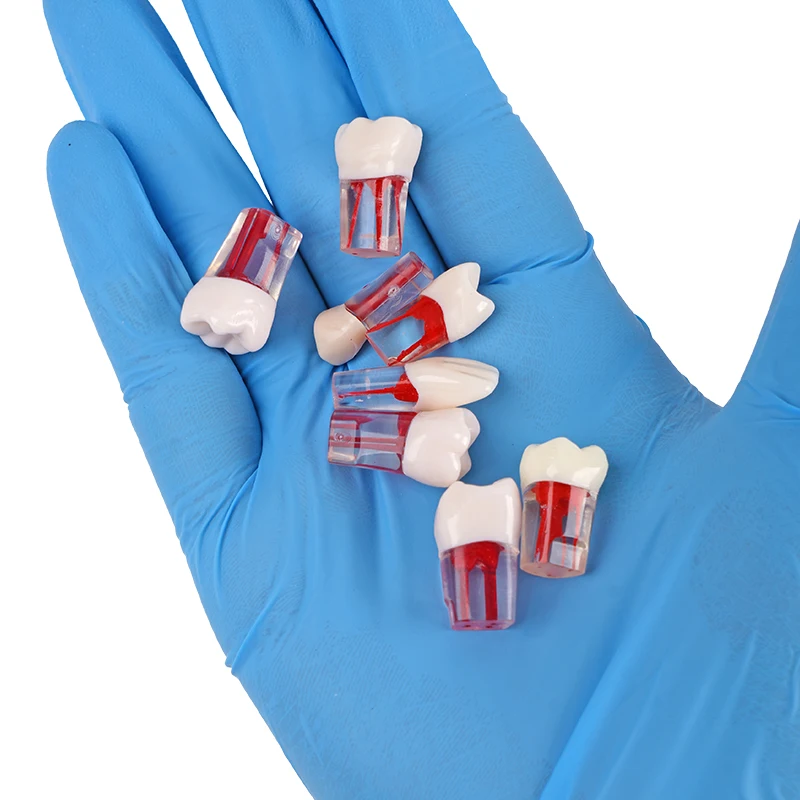 5pcs Dental Teeth Root Canal Model Pulp Files Cavity Endodontic Practice Block Endo File Resin Tooth Dentistry Teaching Material