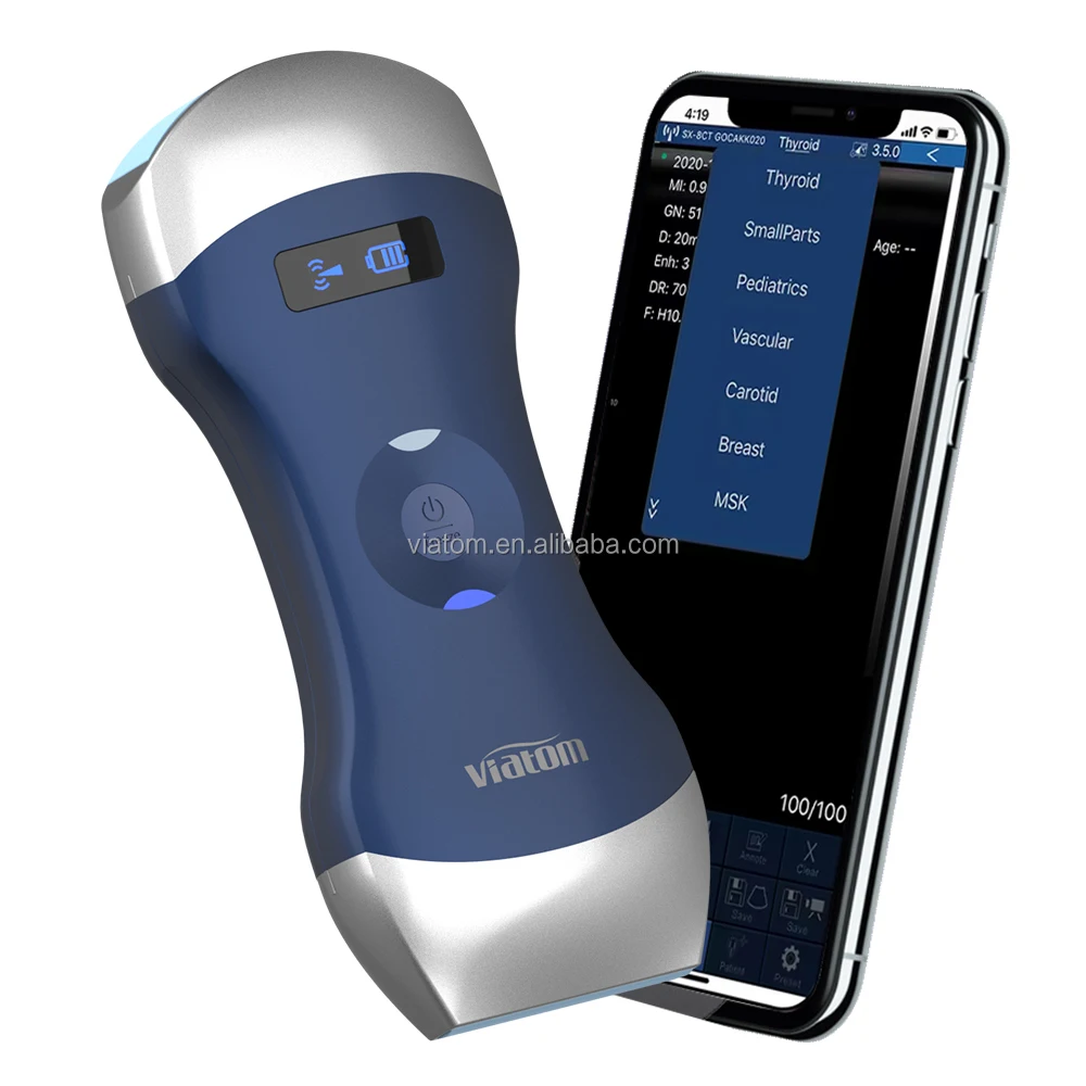 الموجات فوق الصوتية قبل الولادة يقيس الصحة الشاملة والنمو وتنمية الجنين