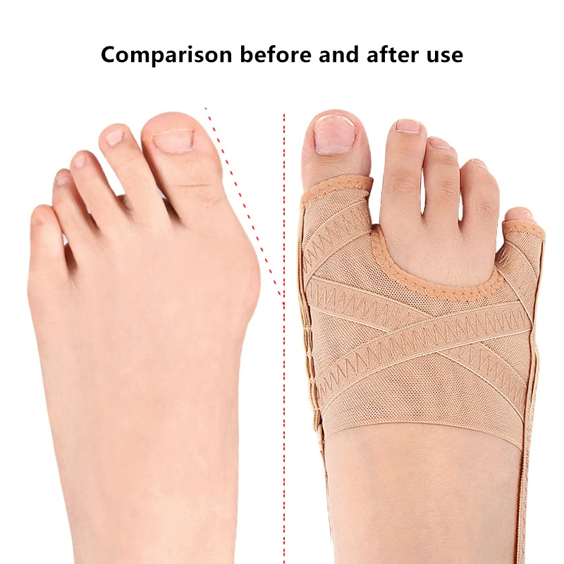 Corrector de juanete Hallux Valgus ajustable, ortopédico, separador de dedo gordo, corrección del pulgar, pedicura, 1 par