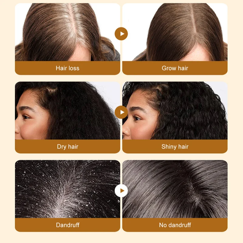 Óleo de Batana natural para o tratamento do cabelo saudável, promove o bem-estar do cabelo, homens e mulheres, melhora o anti-cabelo, 100%