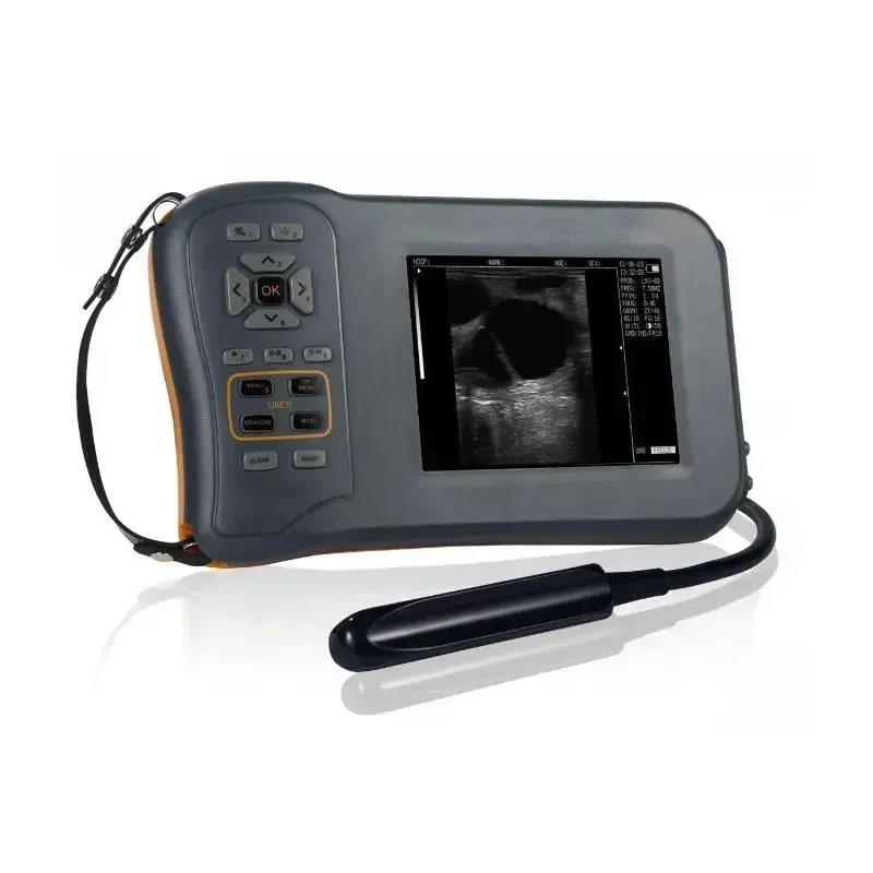 One-stop Medical Supplier MY-A015D Electric Medical UltrasoundInstruments Veterinary Ultrasound Rectal