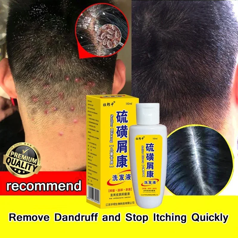 

110ml Sulfur Herbal Shampoo Relieve Itching Dandruff Scalp Acne for Adults Anti-dandruff Shampoo