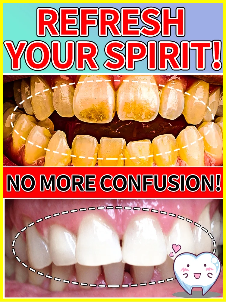 

Probiotic tartar Removing Plaque Stains Yellow Teeth Stains Brighten Whiten Fresh Breath dental Hygiene Health Care