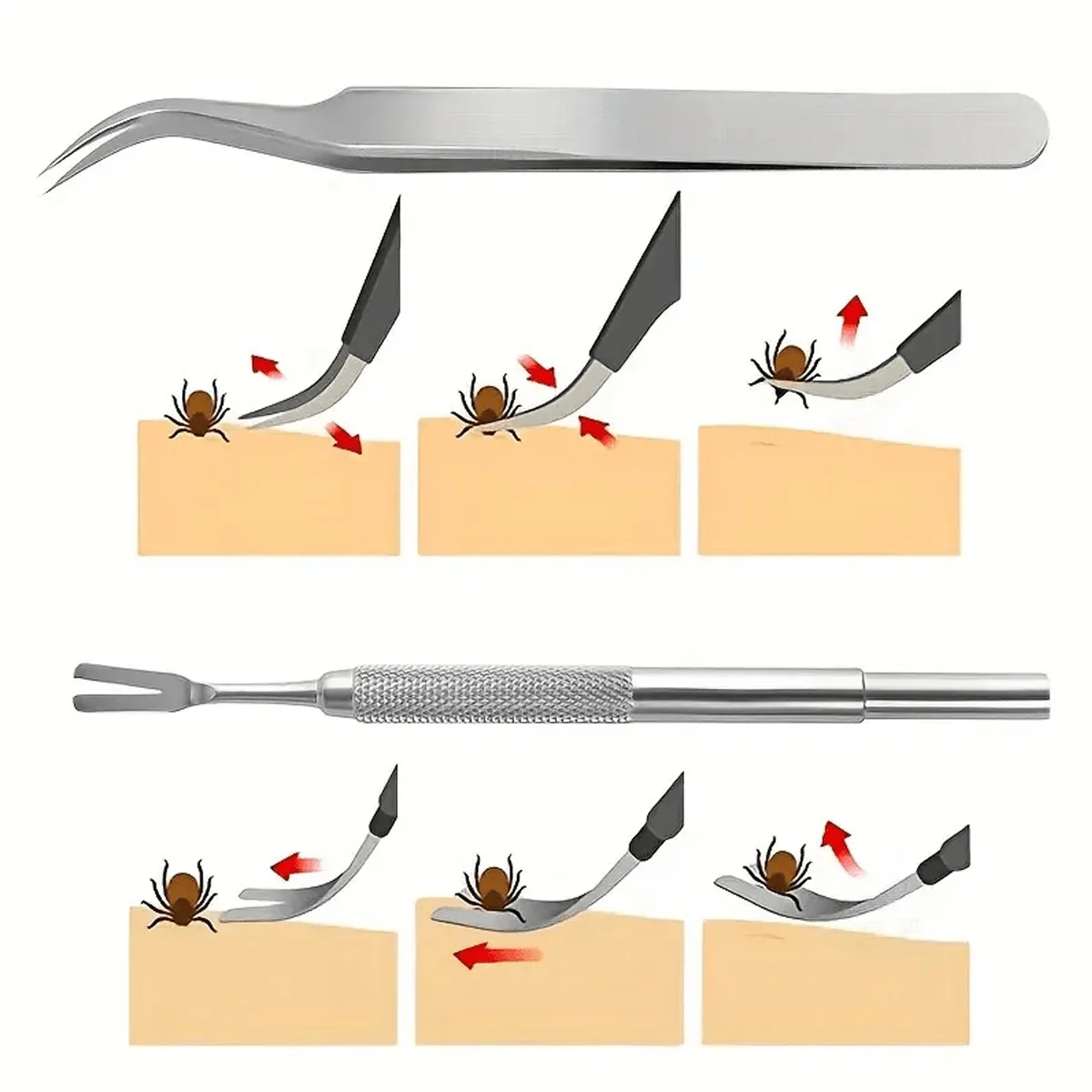 2 Pcs Pet Tick Remover Tool Set, Stainless Steel Flea Lice Removal Tweezers Insect Fork‑Shaped Extractor For Dogs & Cats