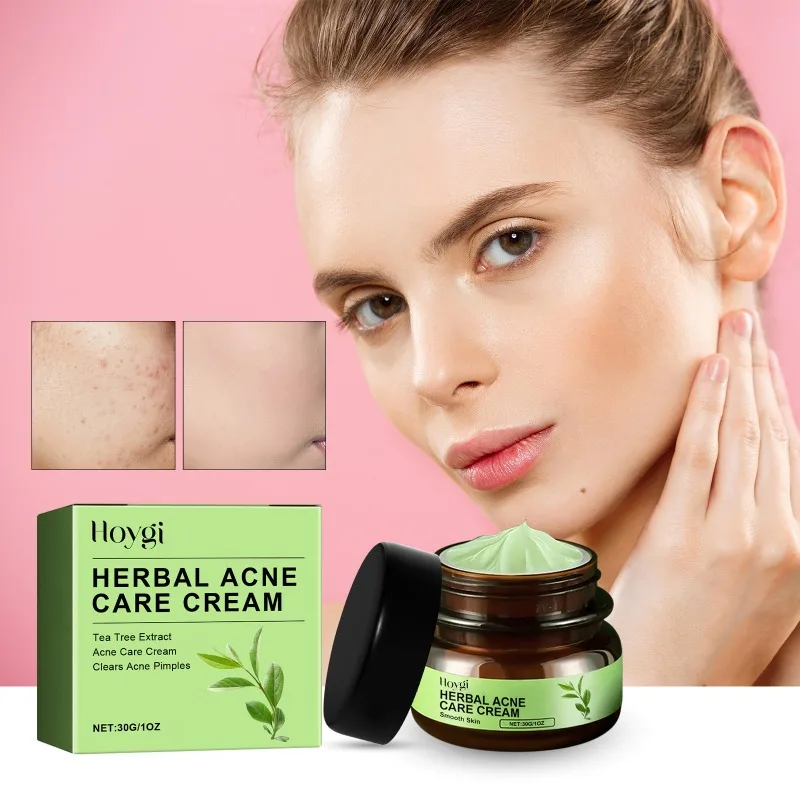 

Herb Acne Removal Cream Treatment Pimple Scar Spots Shrink Pores Oil Control Whitening Moisturize Face Acne Skin Care