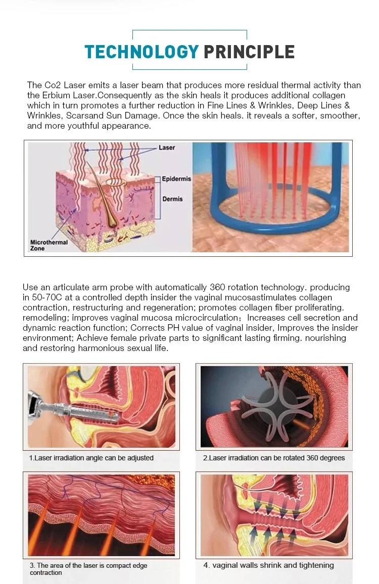 Frax co2 Fractional vaginal Tightening Skin Rejuvenation Anti-Aging Device