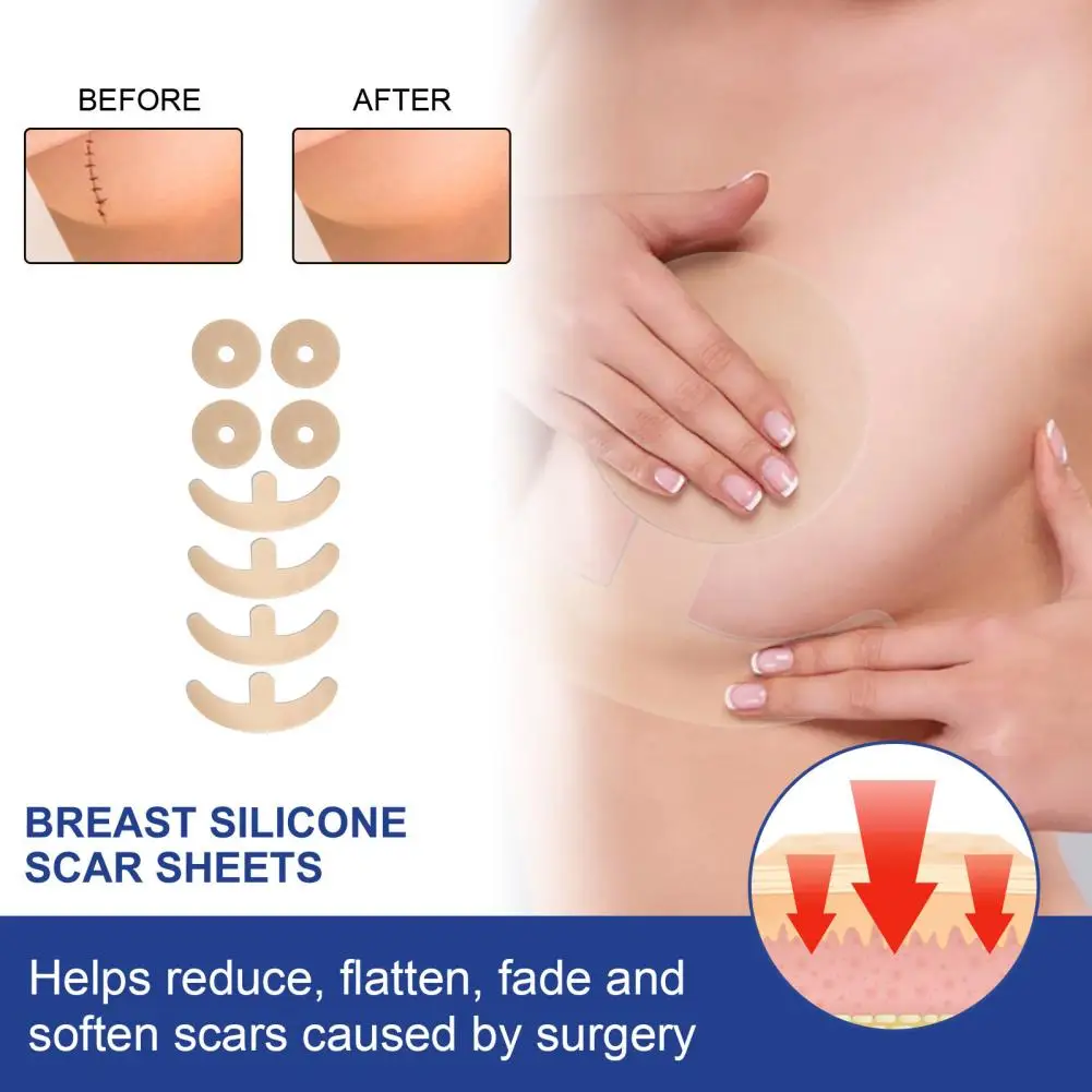 4 Pairs Breast Repair Patch Healthy Breast Scar Comfortable Surgery Patch Light Texture Breast Surgery Patch for Female