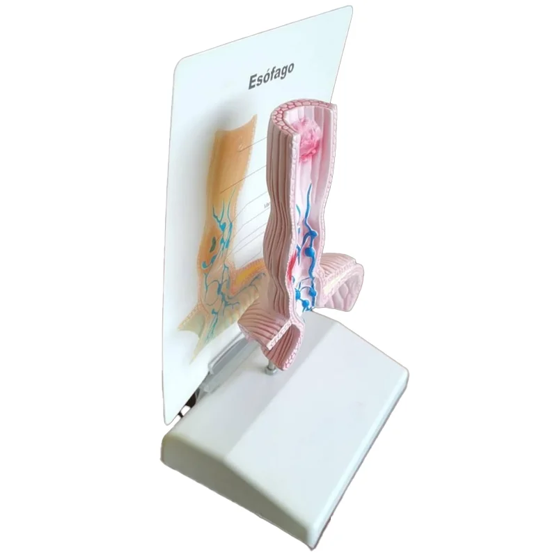 Medical Teaching Esophageal Anatomy Model Clinical Training