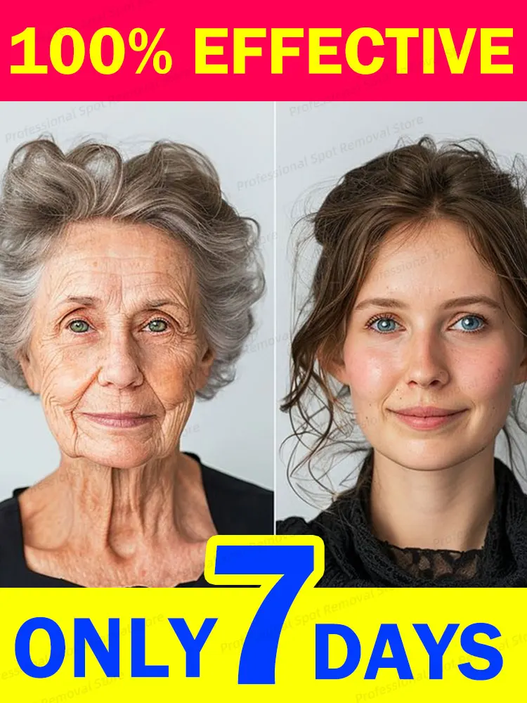 

20 years younger，wrinkles disappear
