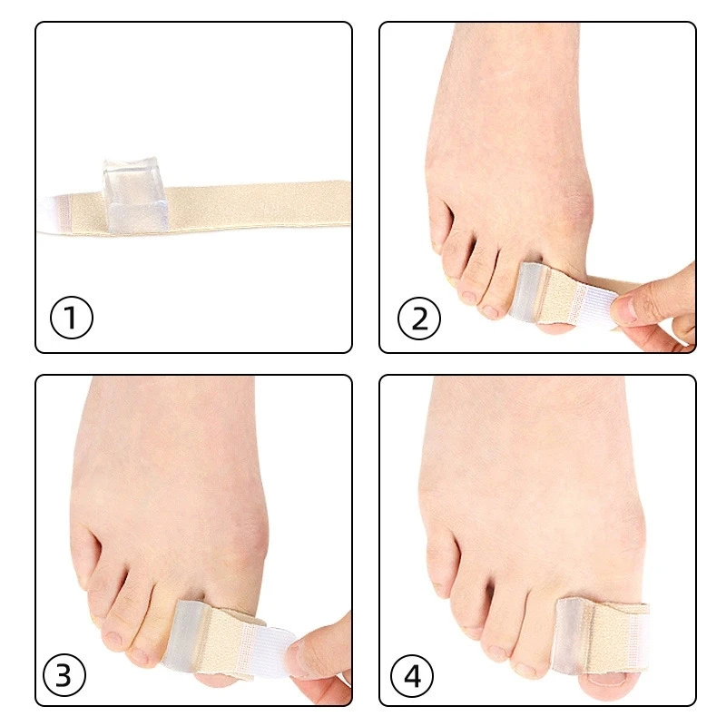 

1/2Pcs Gel Toe Separators Bunion Corrector Bunion Corrector for Overlapping Toe Silicone Spacers for Hallux Bunion Pain Relief