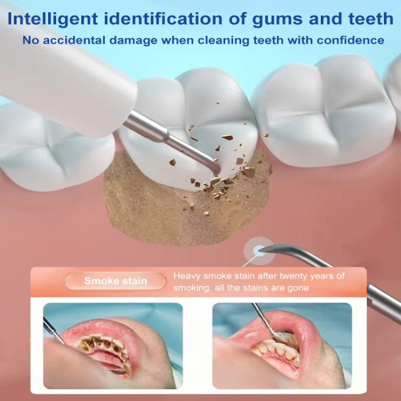 Professional Electric Tooth Polisher for a Shiny Smile