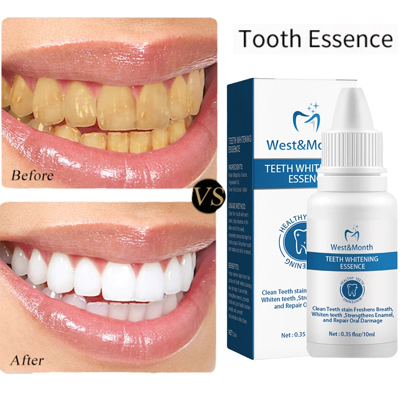 Quickly Teeth Whitening Products Tartar Dental Plaque Remover Professional Effective Teeth Whitener Cleaner Fast Shipping 10ML