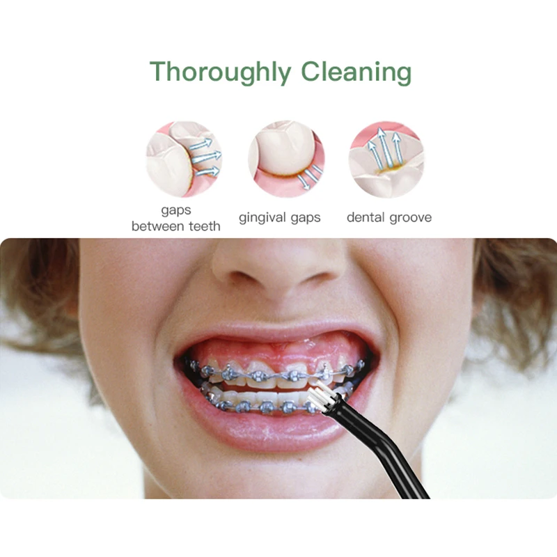 Xiaomi Youpin Oral Irrigator ทันตกรรมแบบพกพา Water Flosser Jet 5โหมด IPX8กันน้ำฟันทำความสะอาดช่องปาก Irrigator น้ำ