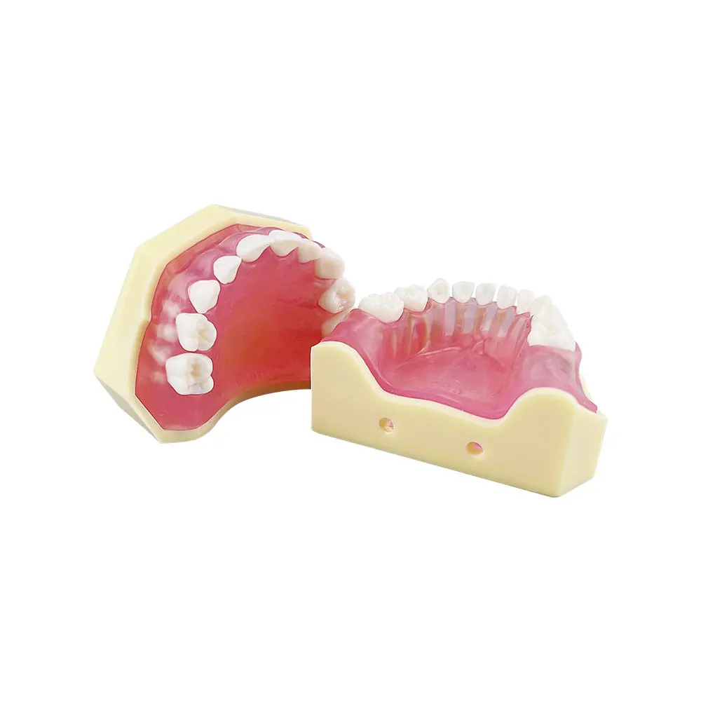 Kids Teeth Model For Training Practice Tooth Extraction Model Dental Standard Model With Removable Teeth Gums Children TYPODONT