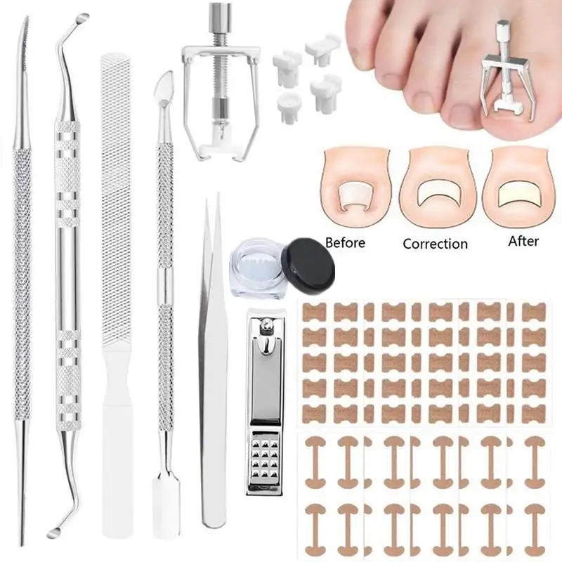 (.) 1 Set Adhesive Toenail Patch Ingrown Toe Nail Correction Sticker Foot Corrector Pedicure Healthcare Tools Toe Treatment Pad